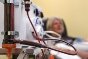 EBOO IV Ozone Therapy for Chronic Conditions