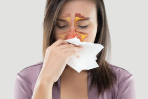 diagram of sinus infection overlayed on woman's face while she blows her nose into a tissue